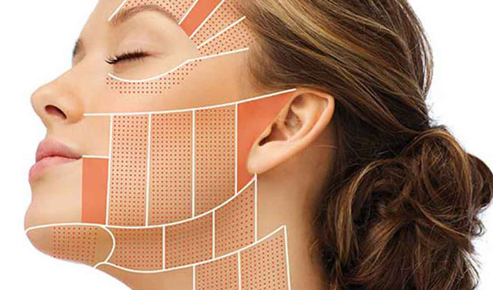 آموزش هایفو تراپی