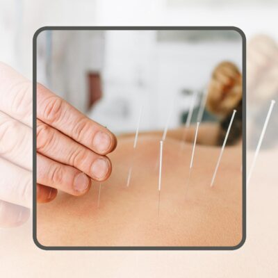آموزش طب سوزنی